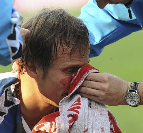 Koál je oetován bezprostedn poté, co v úvodu zápasu na Spart odnesl stet s Holendou zlomeným nosem