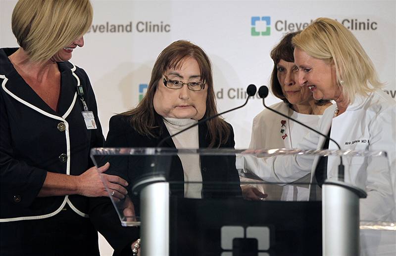 Connie Culpová po transplantaci obličeje se v Clevenlandu poprvé od prosincové operace ukázala na veřejnosti (5. května 2009)
