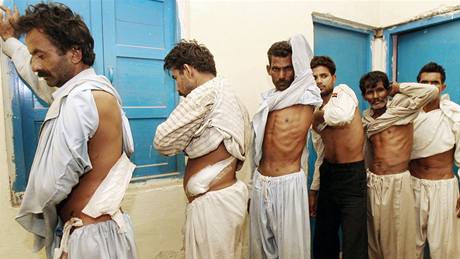 Pákistánci ukazují jizvy po operacích, pi nim jim vzali ledvinu