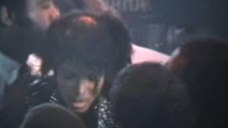 Michael Jackson s ohoelými vlasy po nehod pi natáení reklamy