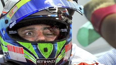 Zraněný pilot Formule 1 Felipe Massa chvíli po nehodě v Budapešti (26. července 2009)