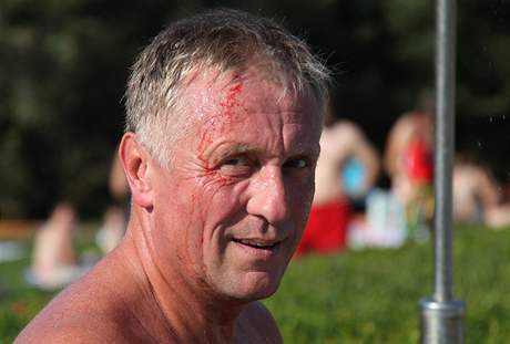 Mirka Topolánka napadli na koupališti v Hustopečích čtyři muži. Kamenem ho zranili na hlavě (21. srpna 2009)