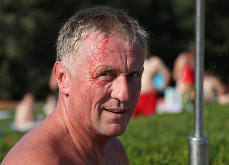 Mirka Topolnka napadli na koupaliti v Hustopech tyi mui. Kamenem ho zranili na hlav (21. srpna 2009)