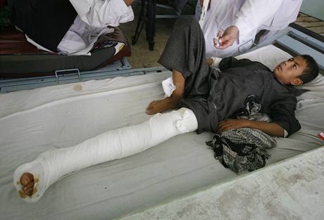 Desetilet Shafiullah se l v nemocnici v provincii Kunduz, kam byl pevezen se zrannmi po nletu NATO.