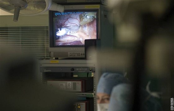 Operace srdce (ilustraní foto)