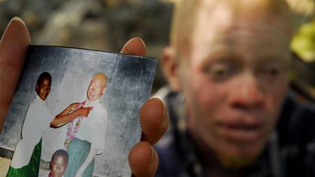 Nelehký údl albín v Tanzánii. Vumilia ukazuje fotografii svých spoluák na ní je sedmnáctiletá albínka, kterou loni v kvtnu zabili dva mui, aby ásti jejího tla prodali amanovi.