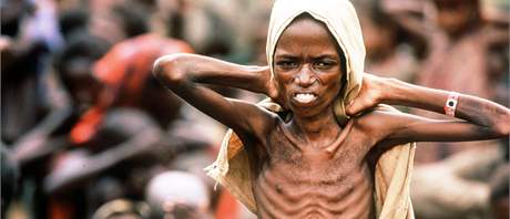 Chlapec v hladomorem postieném Somálsku. Ilustraní foto