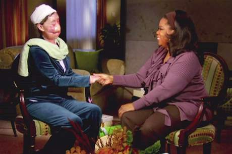 Charla Nashová odhalila v The Oprah Winfrey Show svj znetvoený obliej