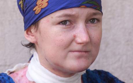 tyiadvacetiletá Olga Joklová trpí vzácnou koní chorobou, která se nedá vyléit.