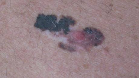Dti do jednoho roku na sluníko nepatí, varují dermatologové (ilustraní fotografie)
