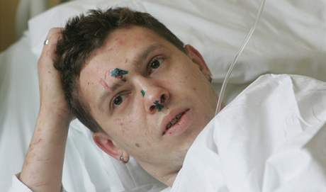 Miroslav klíba, kterého zasypala su po výbuchu kotle. (4. 1. 2010)