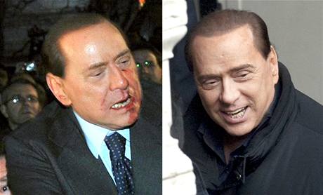 Berlusconi v Miln 13.12.2009 (vlevo) a v m 11.1.2010
