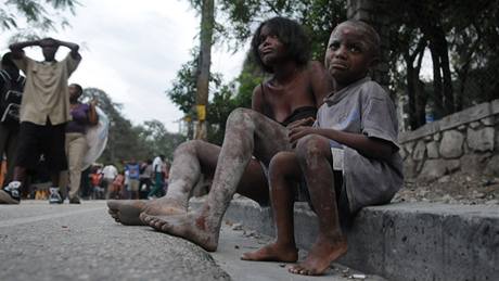 Na Haiti jsou poniené nemocnice a zdravotníci nestíhají ranným pomáhat. (13.1.2010)