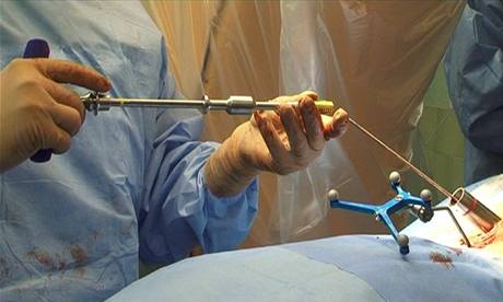 Chirurg pipravuje implantt