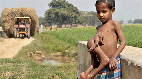 Sedmiletý indický chlapec Deepak Paswaan