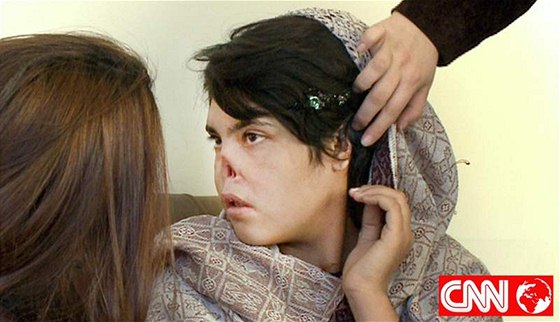 Devatenáctileté Aishe uízl nos a ui vlastní manel.