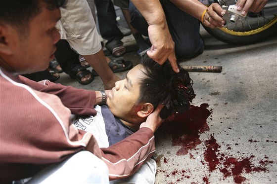 Ranný po stetech mezi bezpenostními slokami a protivládními demontranty v thajském Bangkoku (15. kvtna 2010)