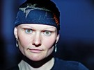 Monika Pospíilová - kvli neznámé nemoci pila o vlasy a vekeré ochlupení 