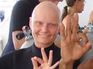 Monika Pospíilová, která trpí univerzální alopecií