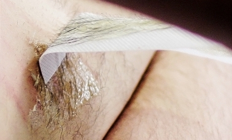 Chlupy se po depilaci voskem znovu objeví zhruba po měsíci, pak se musí procedura opakovat.