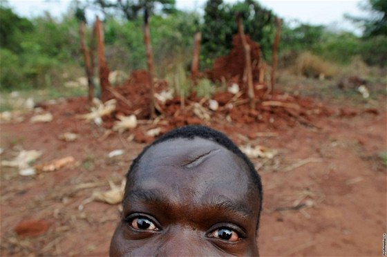 Mu z vesnice Napopo na severovýchod Konga s jizvou, kterou mu zpsobili rebelové maetou. Nkteré oblasti zem stále ovládají skupiny rebel.