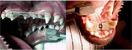 Nejjednodu ps rovntka jsou s gumovmi etzky (vlevo), ta sloitj u maj ortodontick roub