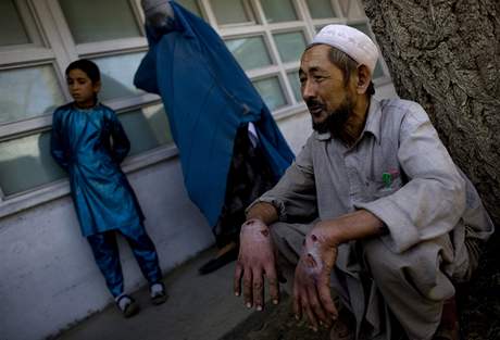 Abdul Razaq, postien kon leishmanizou, ek na oeten v Kbulu.