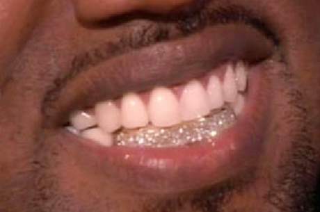 Kanye West m msto zub diamanty