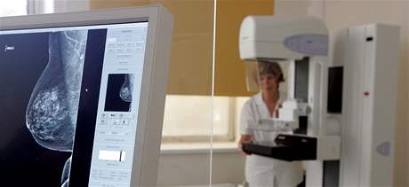 Vyetení na mamografu dokáe odhalit rakovinu prsu v brzkém stádiu. Ilustraní foto