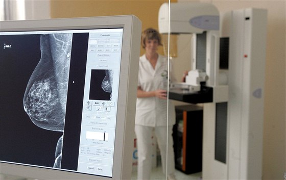 Mamograf (Ilustraní snímek)