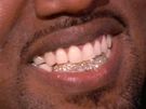 Kanye West má místo zub diamanty