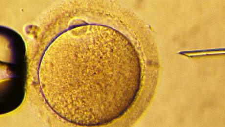 Zavedení spermie do vajíka - snímek ze speciálního mikroskopu atomových sil