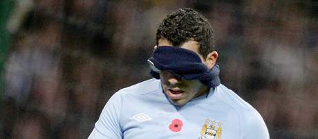 NEJRADI BYCH SE NEVIDL. Carlos Tevez z Manchesteru City zpytuje svdom po zahozen anci v utkn s Birminghamem.
