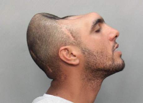 "Mu s polovinou hlavy" Carlos Rodriguez na policejní fotografii