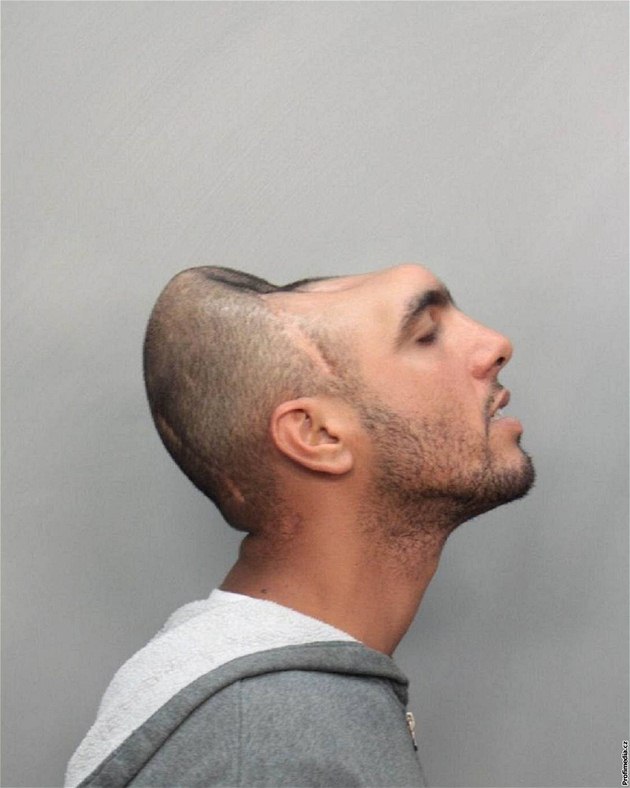 "Muž s polovinou hlavy" Carlos Rodriguez na policejní fotografii