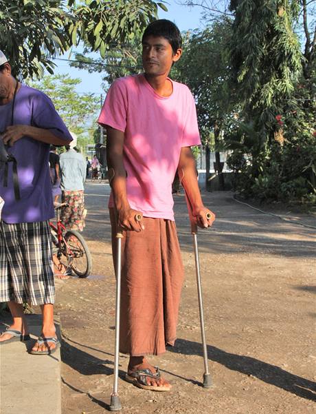 Barmnec bez nohy si piel na kliniku Mae Tao pro pomoc