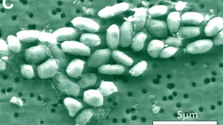 Mono Lake bacteria (arsenic based)