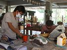 Barmánec piel o nohu pi výbuchu armádní miny, na klinice mu vyrobí protézu