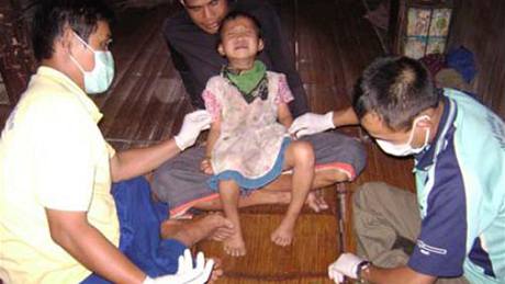 Mobilní zdravotnické týmy se na východ Barmy snaí pomoct i tm nejmením 