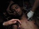 Lékai oetují mladého Egypana zranného pi nepokojích (28. ledna 2011)