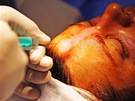 Plastická operace oblieje MedicomVIP - infiltrace roztoku anestetika a adrenalinu