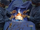 Plastická operace oblieje Medicom VIP - plastika horních víek, operaci provádjí simultárn dva chirurgové
