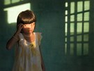 2. cena Soudobé problémy (jednotlivý snímek) - Nguyen Thi Ly, devítiletá ob chemické zbran Agent Orange ve Vietnamu.
