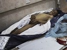 Libyjtí lékai oetují zranné v Adedabíji (3. bezna 2011)