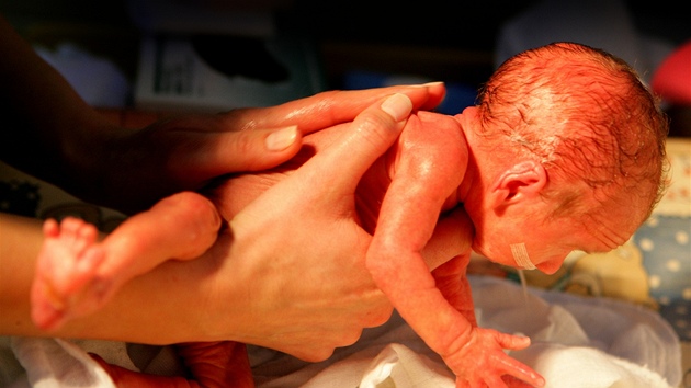 Amillia Taylorová se narodila ve 22. týdnu thotenství a váila pouhých 284 gram, pesto ji lékai zachránili