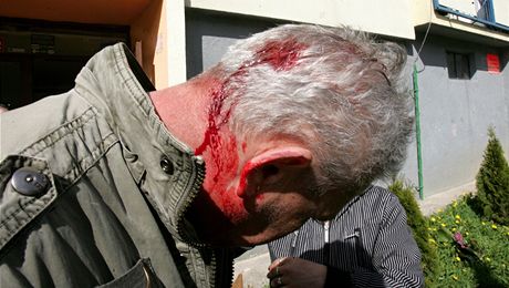Mu po útoku druky krvácel z hlavy. Kdyby neutekl, mohl dopadnout jet he. (ilustraní snímek)
