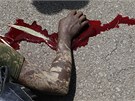 Zranný voják Alassaneho Outtary v Abidanu (6. dubna 2011)