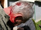Mu zranní pi potyce demonstrant s policií v Krupce (9. dubna 2011)
