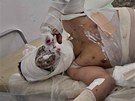 Zranný povstalec v nemocnici v Adedábíji (17. dubna)