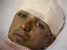 Zranný mu evakuovaný z obléhané Misuráty (27. dubna 2011)
